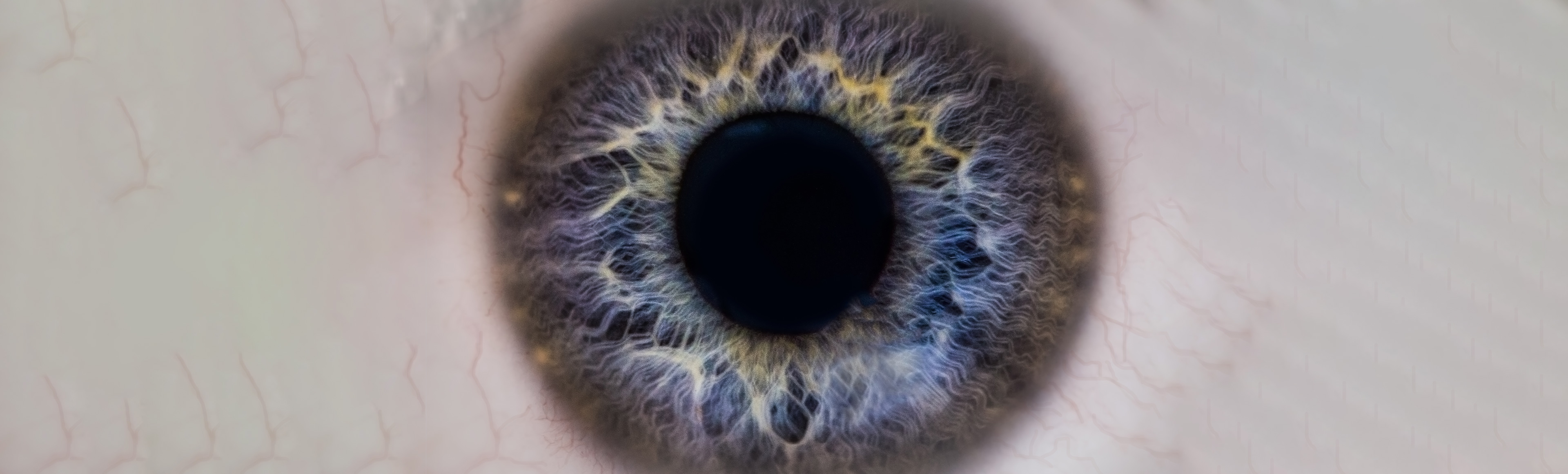  A woman placing a contact lens into her left eye.